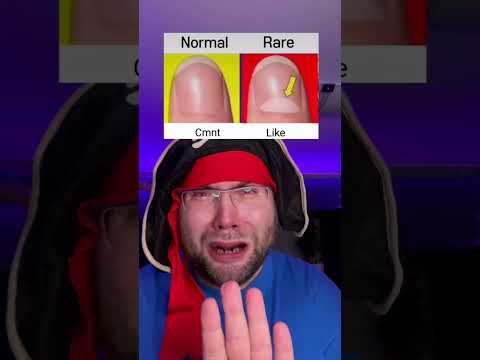 Normal or rare? guide at the end.