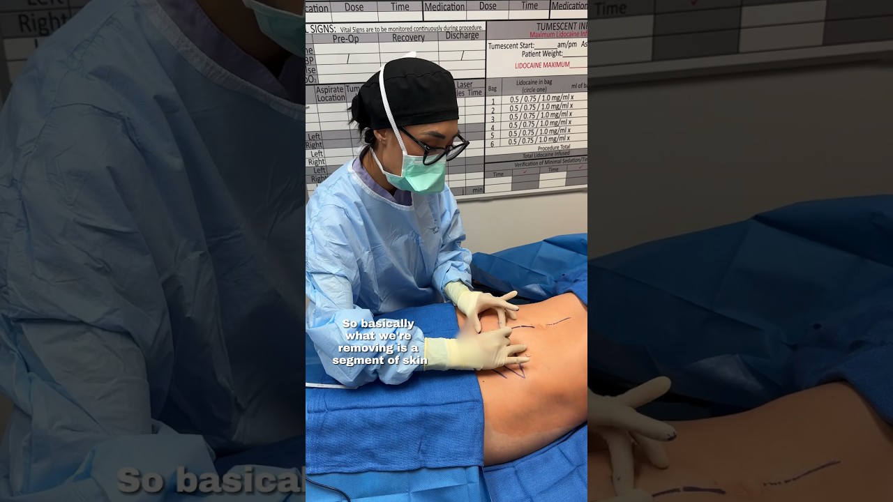 Surgeon explaining skin removal procedure in operation.