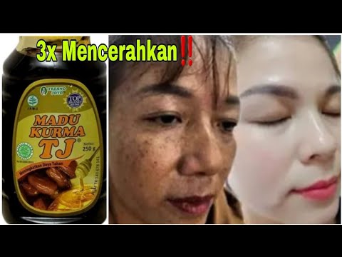 HATI-HATI ‼️INI DIA EFEK JANGKA PANJANG MENGGUNAKAN MASKER MADU.TONTON SBLM MEBYESAL.