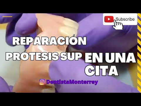 REPARACIÓN  Prótesis Total👅 diente central en UNA SOLA CITA
