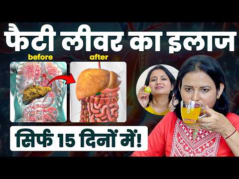 मेरा लिवर डिटॉक्स प्लान | सिर्फ 15 दिन में गंदगी साफ!