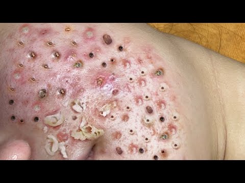 Most Satisfying and Relaxation with An Spa Video #2119