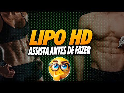 🔥 5 COISAS QUE VOCÊ PRECISA SABER ANTES DE FAZER LIPO HD! ⚠️