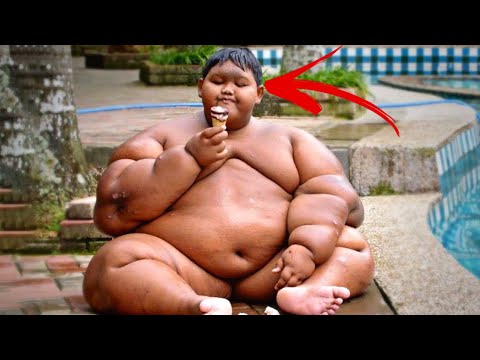 Lembra Do Menininho Que Pesava 200 Kg? É Isso Que Aconteceu Com Ele