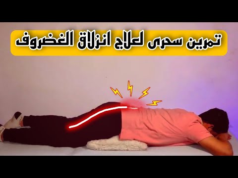 علاج فورى ومضمون ١٠٠٪  للانزلاق الغضروفي وعرق النسا |سبب عرق النسا وعلاجه |الم اسفل الظهر والمؤخره