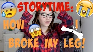 Storytime: I BROKE MY LEG!
