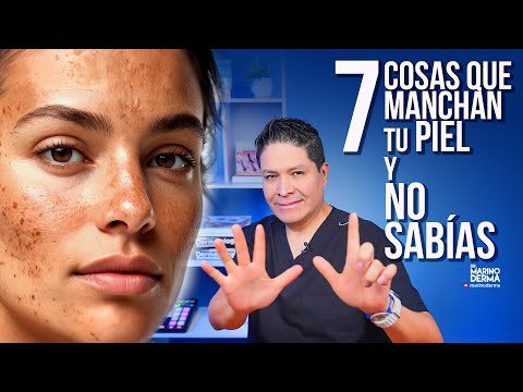 7 COSAS QUE MANCHAN TU PIEL Y NO SABÍAS