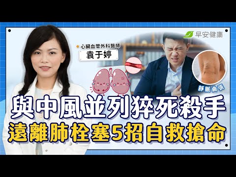 與中風並列猝死殺手！遠離恐怖肺栓塞，5關鍵自救搶命︱袁于婷 心臟血管外科醫師【早安健康X健康大頭條】
