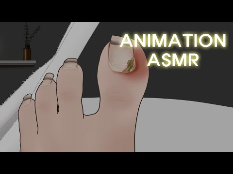 고막에 때려박는 팅글 사운드! 리얼한 내성 발톱 치료 애니메이션 ASMR / Ingrown Toenail Removal treatment