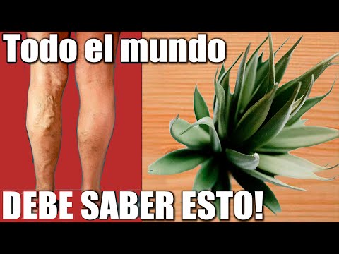 Así Logré Reducir Mis Várices con un Solo Ingrediente Natural