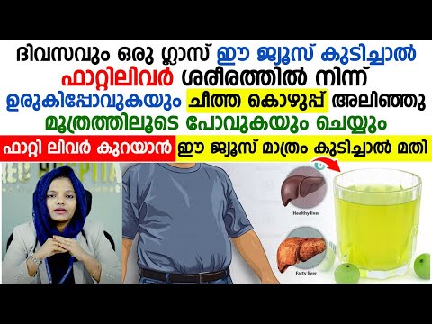 ഫാറ്റി ലിവർ കുറയാൻ ദിവസവും ഒരു ഗ്ലാസ് ഈ ജ്യൂസ് മാത്രം കുടിച്ചാൽ മതി | fatty liver maran tips