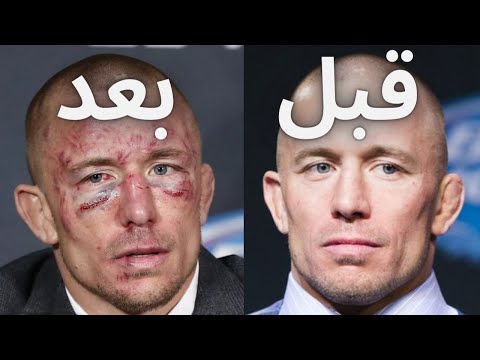 شاهد قصة النزال الذي غيّر ملامح الأسطورة جورج سانت بيير وجعله يفقد الذاكرة ودفعه إلى الإعتزال