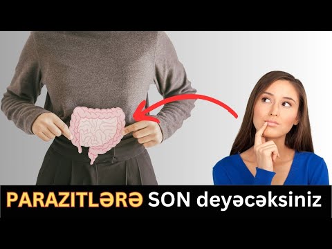 Parazitlərdən qurtulmağın ən asan yolları