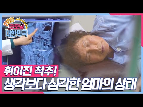 [엄마를 부탁해] 🚨생각보다 심각한 엄마의 상태에 과연 의료진이 긴급하게 내린 결정은? [굿모닝 대한민국] KBS 250208 방송