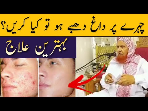 Chehre Par Daag Dhabbe Aur Khubsurti Ka Behtareen Ilaj | Maulana Makki Al Hijazi | Islamic Group