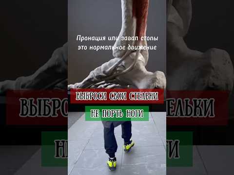 ТОП-3 упражнения при динамическом вальгусе стопы #стопы #вальгус #тренировка