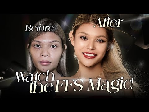 How Facial Feminisation Surgery changed my WHOLE life💖| @Johnreyslife's glow-up at Braun! (Part 1)