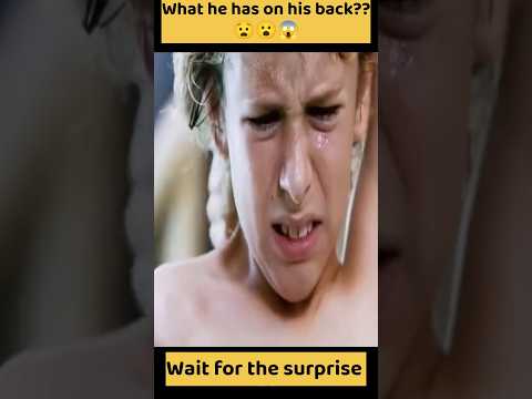 What does he have on his back?