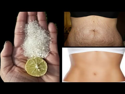 सिर्फ चंद मिनटों में STRETCH MARK पर इतना कमाल का असर करेगा की दुनिया आप से पूछने लगेगी