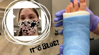 Splint Off And Cast On Vlog!!!