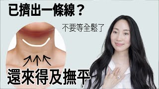 脖子最洩漏年齡！脖紋消失最快的方法@DrGrace