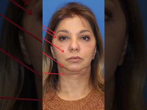 60 Year Old Woman Looks 20 YEARS YOUNGER!