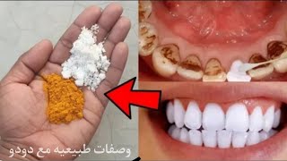 أقسم بالله لن تحتاج للذهاب لطبيب الأسنان لتبييض الاسنان وإسقاط الجير سيسقط لوحده فقط بهذا المكون.