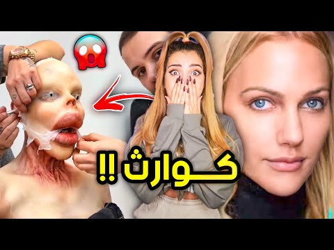 اشخاص جابو العيد بأنفسهم !ابشع عمليات تجميل في العالم !!