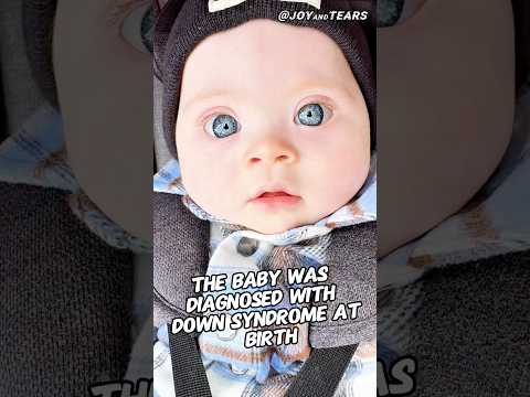 Babies with Down syndrome will always have the best mothers in the world๐ฅฐ#shorts