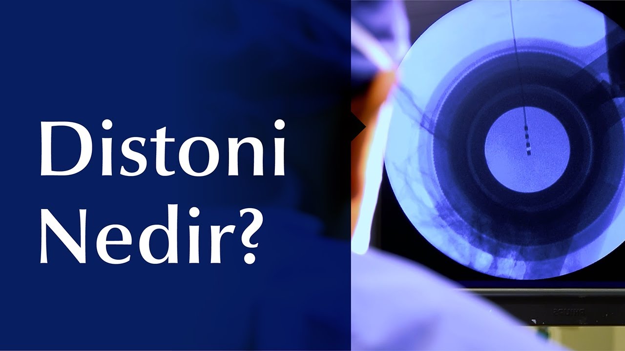 Distoni Hastalığının Nedenleri, Belirtileri ve Tedavisi