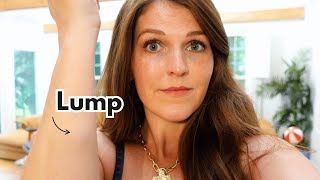 I have a lump in my arm.