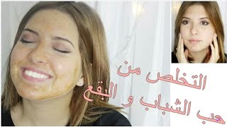 قناع رائع للتخلص من حب الشباب و البثور