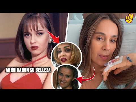 Famosas que lucen irreconocibles por el BOTÓX.