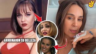Famosas que lucen irreconocibles por el BOTÓX.
