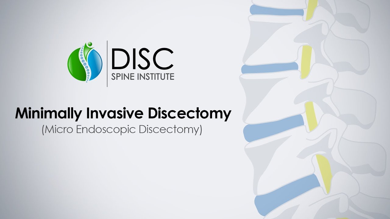 Minimally Invasive Discectomy