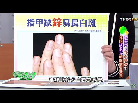 指甲有白斑是因為缺鋅？！找回缺很大的營養素 健康2.0 20160403 (1/4)