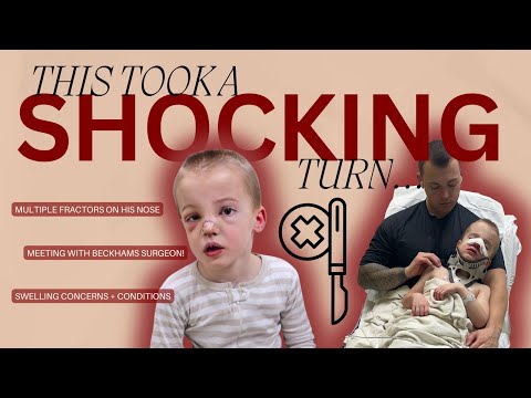 Beckhams Surgery CHANGED!? | Fracture Severity, Swelling and Recovery