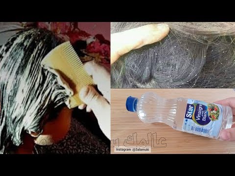 ملعقة خل واحدة وتخلصي من القمل و الصيبان  نهائيا من الأستعمال الأول ولن يعود  مجددا خاصة لدى الأطفال