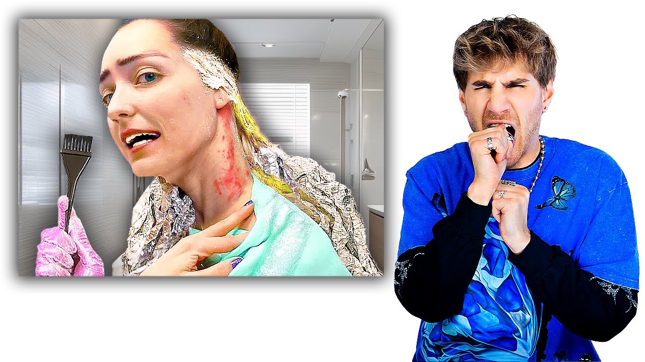 Hairdresser Reacts To CHEMICAL BURN Bleach Fails