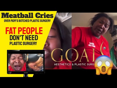 Meatball cries over mom's botched plastic surgery