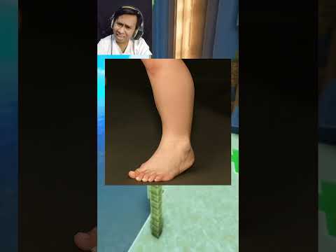 Tebak Anomali Misterius Part 6