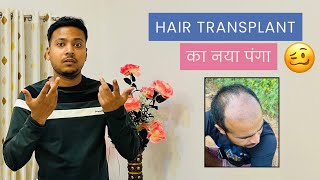 Hair Transplant  का नया पंगा 🤯 दो बार करना पड़ा रहा Hair Transplant 🫨 #hairtransplant 