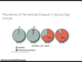 Epidemiology of Periodontal Disease