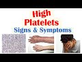 High Platelet Levels and Related Symptoms