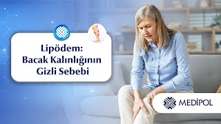 Bacaklarda Ağrılı Yağ Birikimi: Lipödem ve Tedavi Seçenekleri