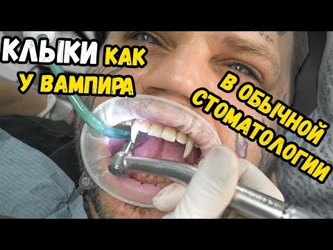 Делаю клыки как у ВАМПИРА ! БОЛЬНО ? сколько стоит ?