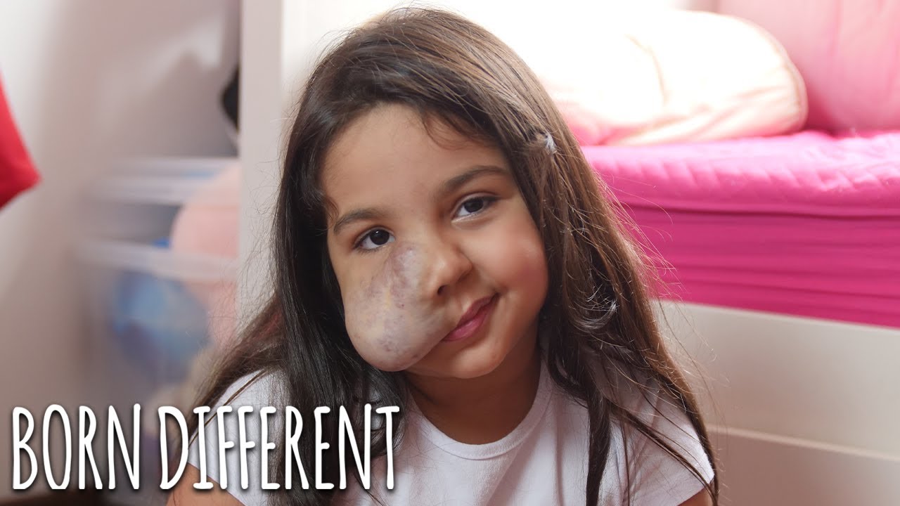 6-year-old with facial tumour gives make-up tutorials - born different