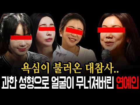 성형 욕심부리다 한순간에 예쁜 얼굴을 잃은 여배우들 TOP5