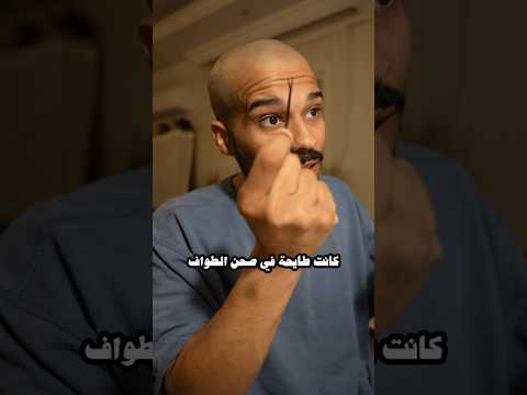 بسبب توكة شعر فقط 💔