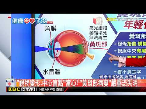 【健康GO了沒】黃斑部病變「年輕化」！  醫：相當於眼睛的癌症@newsebc - YouTube